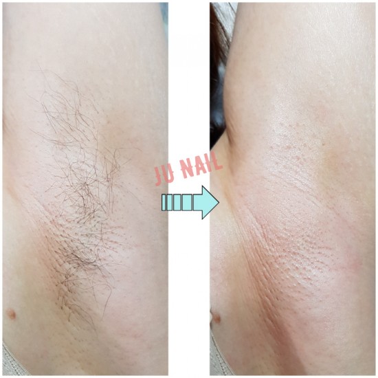 겨드랑이왁싱/분당용인수원수지동백보정동죽전동/주네일 겨드랑이왁싱/분당용인수원수지동백보정동죽전동/주네일