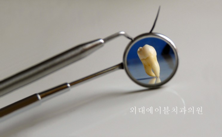 [이문동, 회기동 치과] 치과 기본진료비용 안내