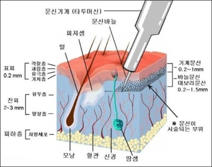 피부 다이어그램 문신의 레이어