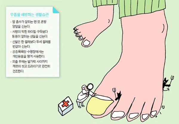 무좀 증상 예방법은 이제 지켜야 해요. 12