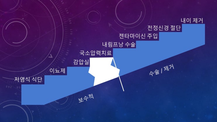  메니에르병 치료 절차