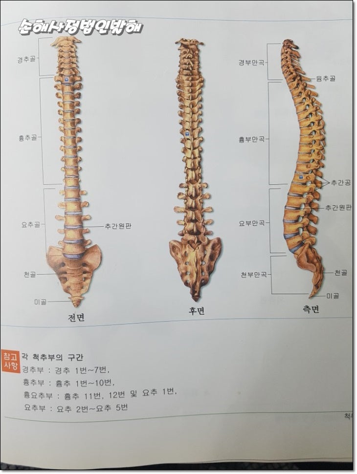 경산손상조절장치 횡돌기(극돌기) 골절보상기준