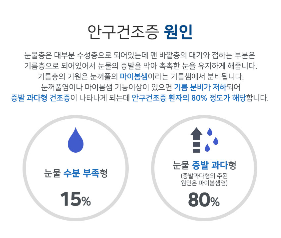 강남구와 안구건조증의 원인으로 빨리 해결되는 곳