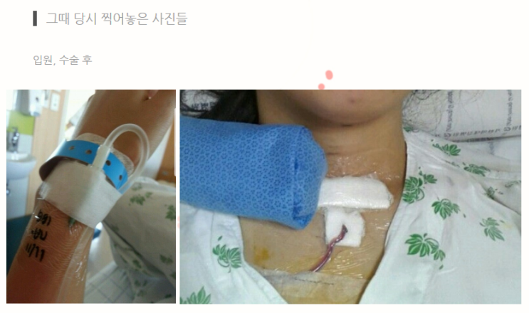  2013년도 첫 갑상선암 수술 / 전체적인 과정 (긴글주의)