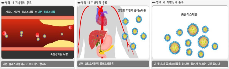 콜레스테롤 검사에는 어떤 것들이 있나요? 이영암내과의원