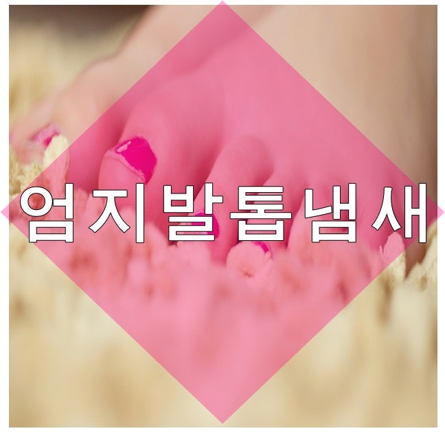 엄지발톱 냄새 원인과 제거 방법