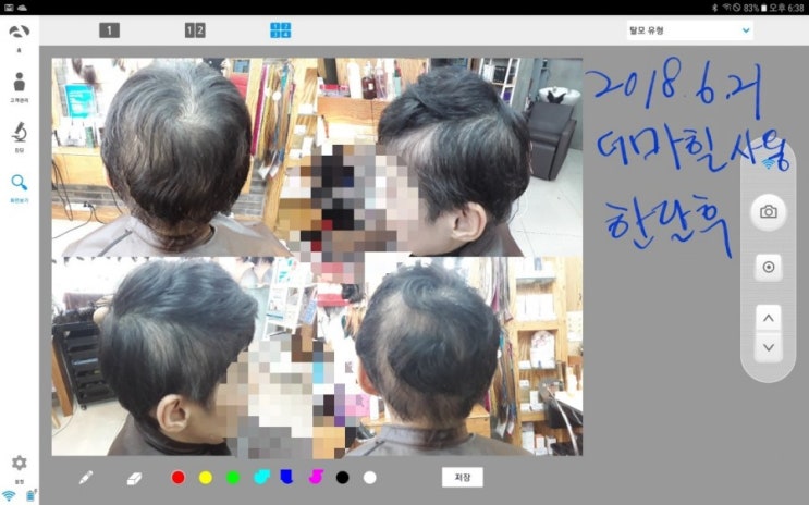  춘천가발 김호증모 원형탈모 다발성탈모로 패션가발착용 및 더마힐제품으로 두피관리까지~ 이은주헤어살롱의 고객관리 프로젝트~