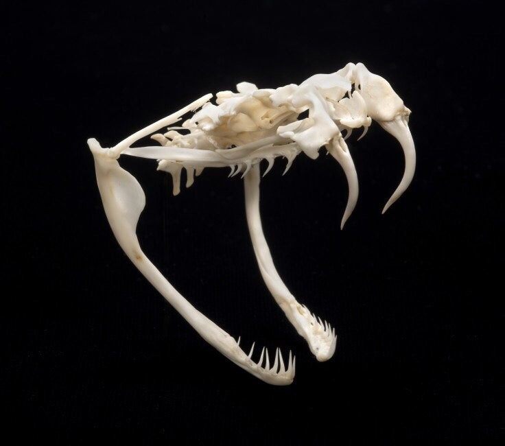 jaw-temporomandibular-joint