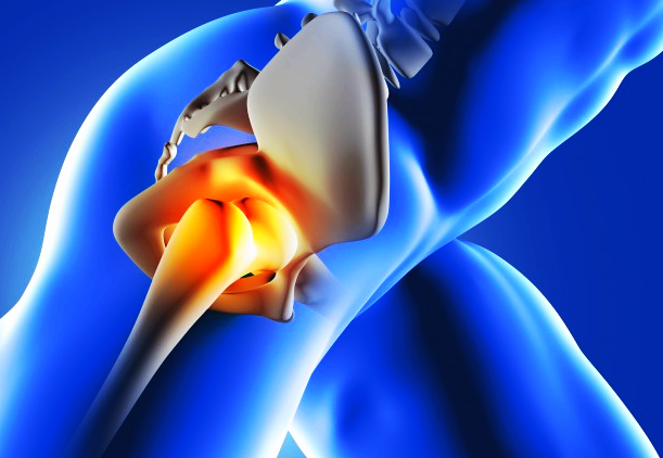 왼쪽,오른쪽 엉치와 골반 고관절 통증원인&증상 : 네이버 블로그