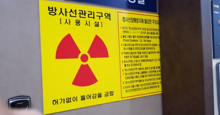  갑상선암 수술 후 동위원소 치료 3박4일 입원