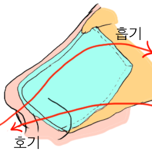  비후성비염 수술로 시행하는 고주파비염수술에서 비밸브의 중요성