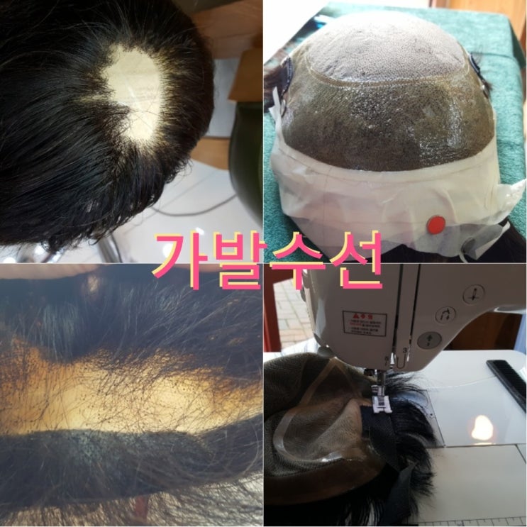  가발수선 가발숱보강 찢어진가발수선