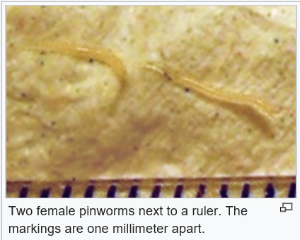 pinworm trăiește în ea