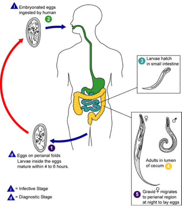vulvovaginitis és pinworms