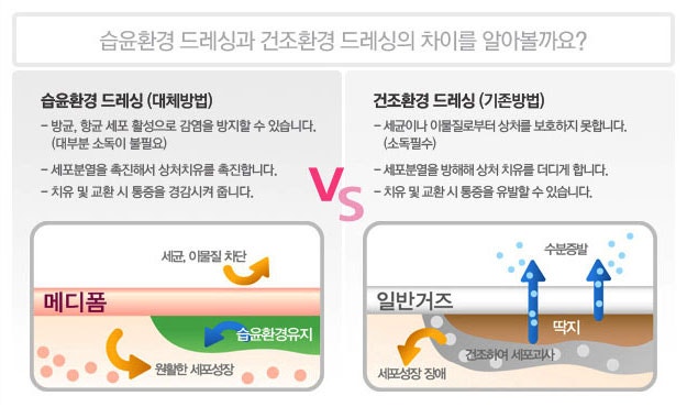 김해대한약국]상처 드레싱 - 2편 (습윤 드레싱, 메디폼) : 네이버 블로그