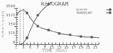 신장이식 후 핵의학 검사(MAG3 Renogram) : 네이버 블로그