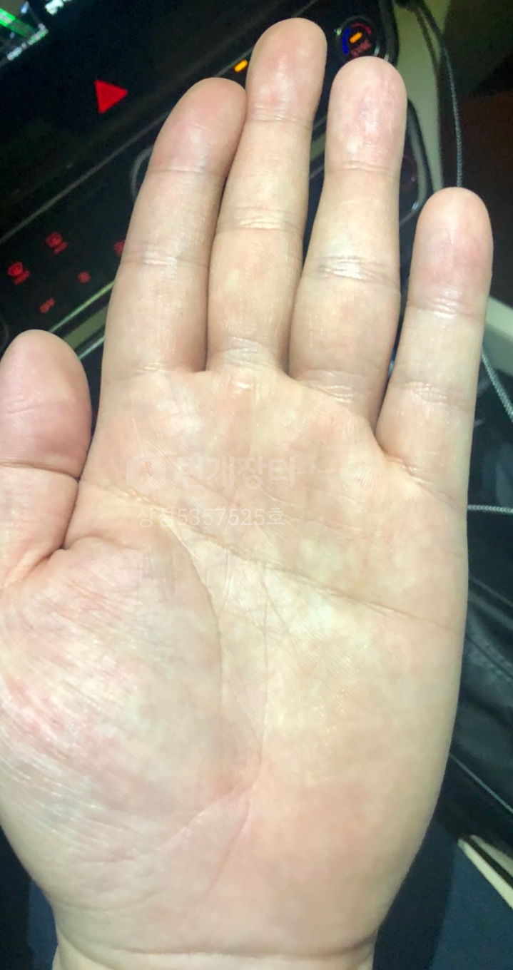 손금(일자손금,막쥔손금,원숭이손금)그리고 손모양 : 네이버 블로그 손금(일자손금,막쥔손금,원숭이손금)그리고 손모양 : 네이버 블로그