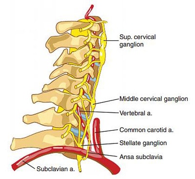 성상 신경절 차단(SGB, Stellate Ganglion Block)