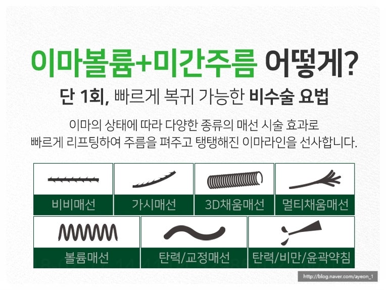 미간주름없애는법 인상을 바꿔주는 매선침 : 네이버 블로그