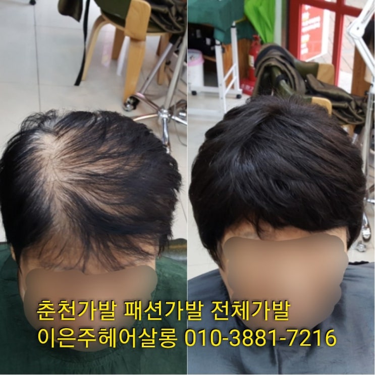  춘천가발 김호증모 패션가발 전체가발로 흰머리커버 및 자신감 회복합니다~^^