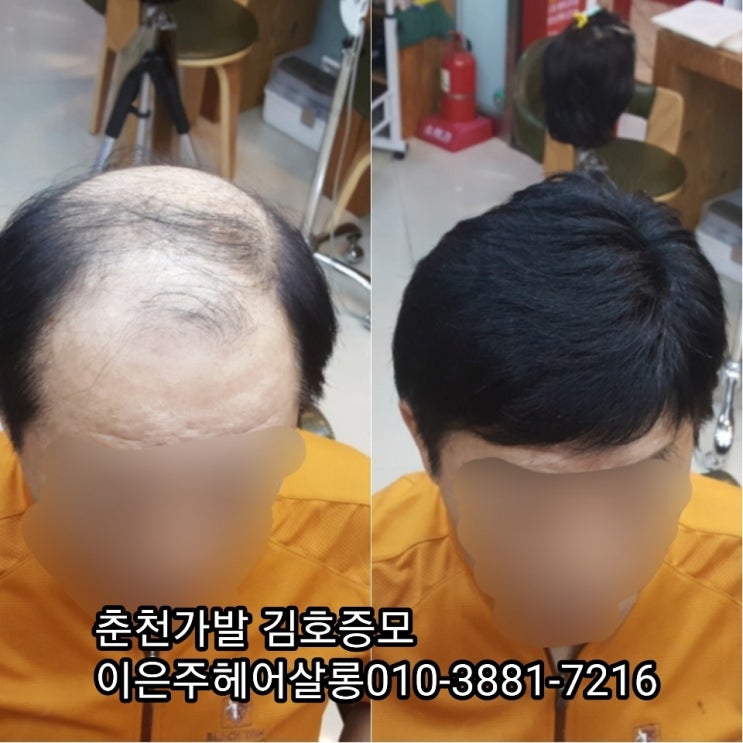  춘천가발 김호증모 및 타사가발도 남자가발관리는 이은주헤어살롱입니다~^^