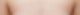 부유방 수술 왜 할까? 전편(1/2) 사진 3