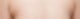 부유방 수술 왜 할까? 전편(1/2) 사진 2