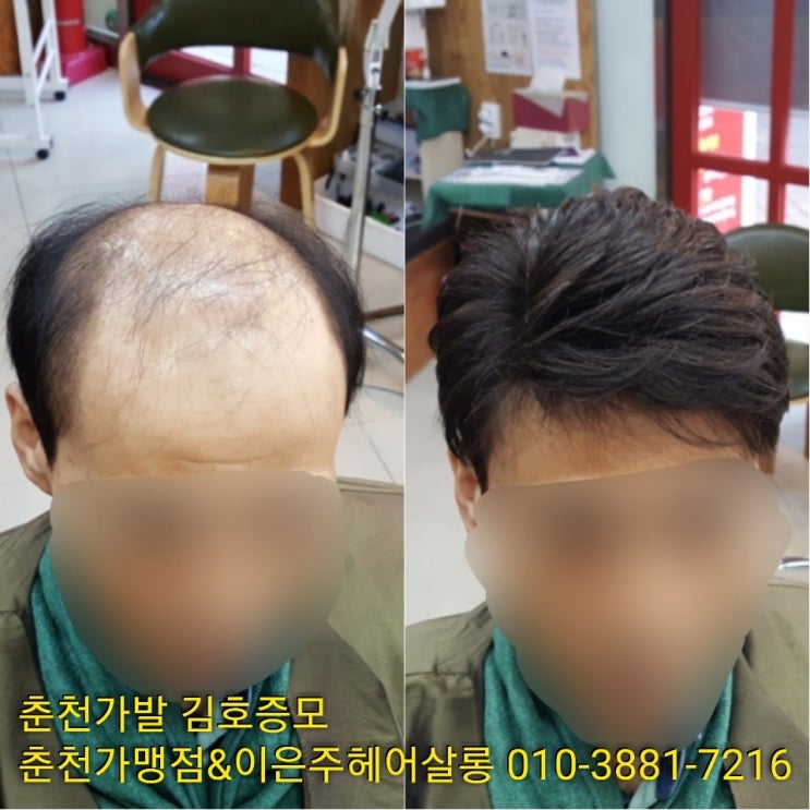  춘천가발 김호증모 가발관리받는날! 기다려집니다~