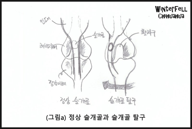 정상 vs 탈구 슬개골 그림