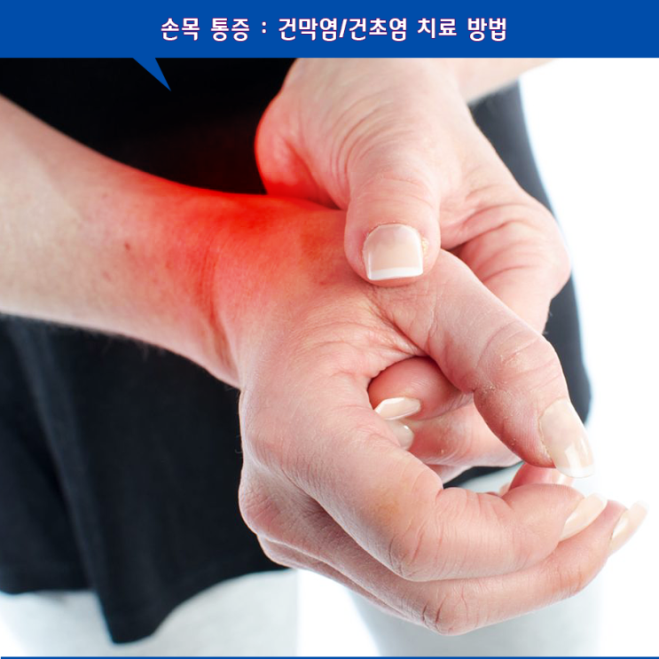 손목 통증, 염증 혹은 인대 파열? 9