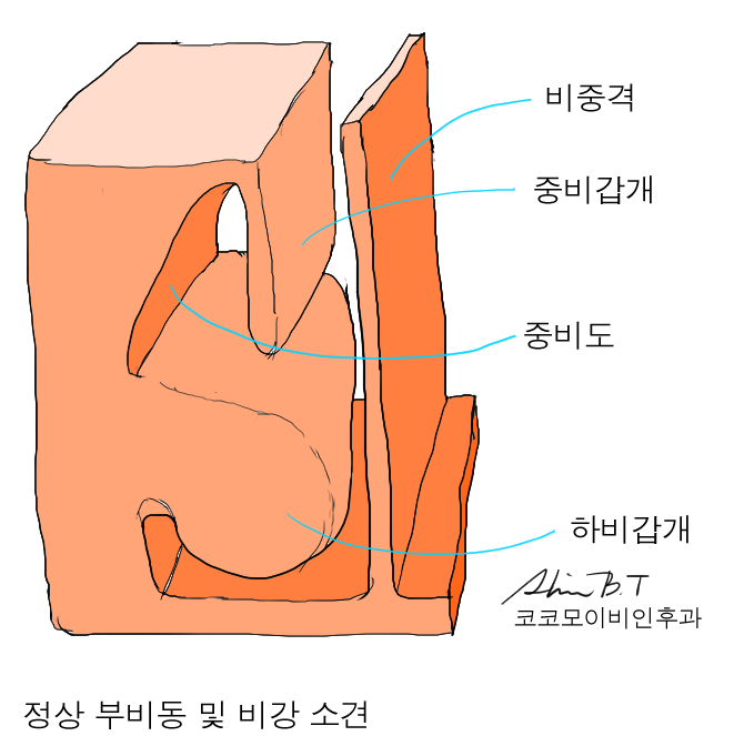  곰팡이균 축농증 ( 진균성 부비동염 ) 수술이 아픈가요?
