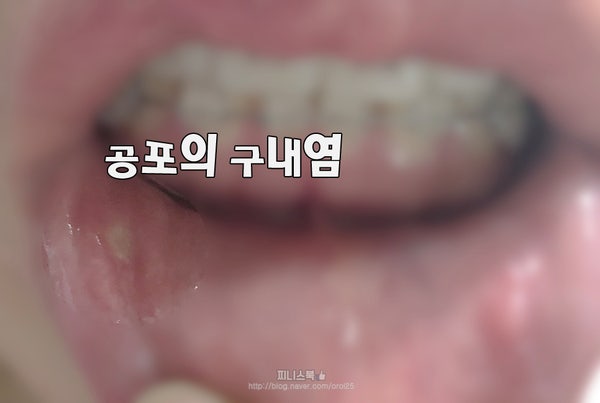 전주치 교정디테일까지 꼼꼼하게 다듬으면서 8