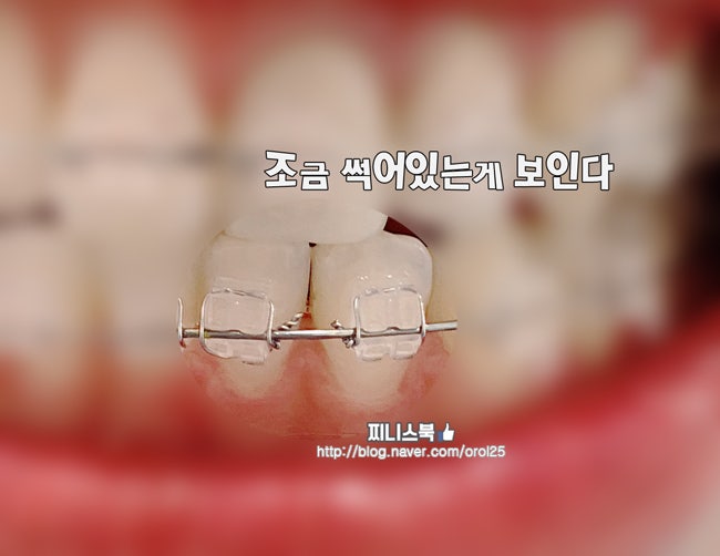 전주치 교정디테일까지 꼼꼼하게 다듬으면서 7