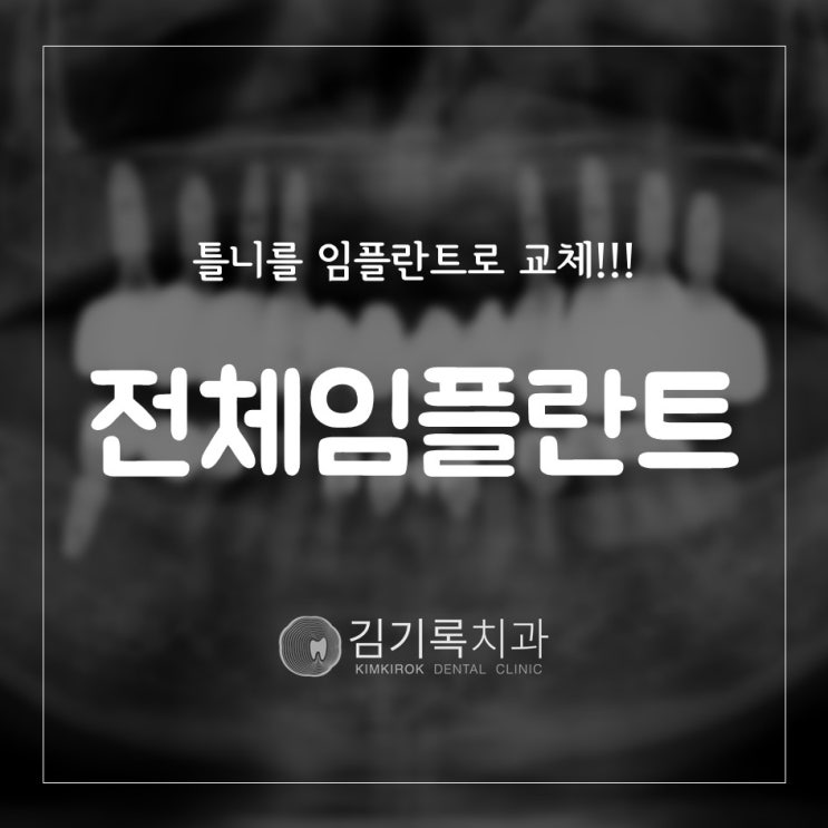 동탄치과추천 틀니를 임플란트로 교체하고 싶어요 김기록치과 수원점 전체임플란트