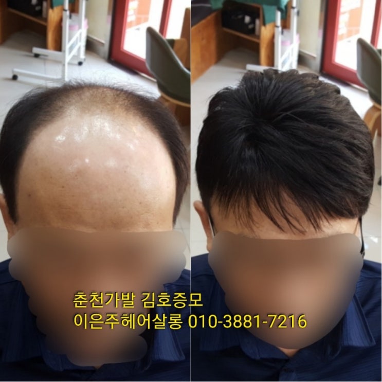 춘천가발 김호증모 남자가발관리는 이은주헤어살롱에서 받으세요^^~