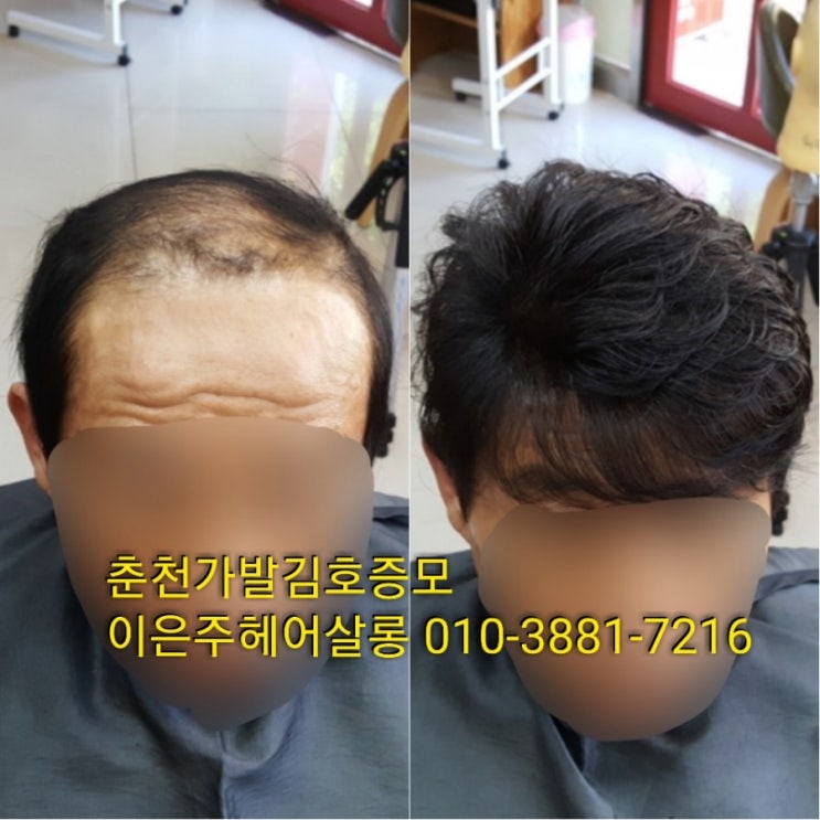  춘천가발 김호증모 가발숱보강 가발증모 수선가발 피팅 합니다~^^