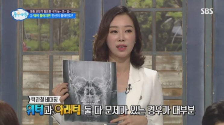  SBS <좋은아침> 노년의 생존교정, 턱관절, 치아교정, 치주교정, 매직키스치과 정유미원장, 정유미치과 20180720