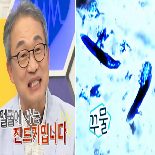  몸신 양배추팩 모낭충 제거 양배추팩만드는법
