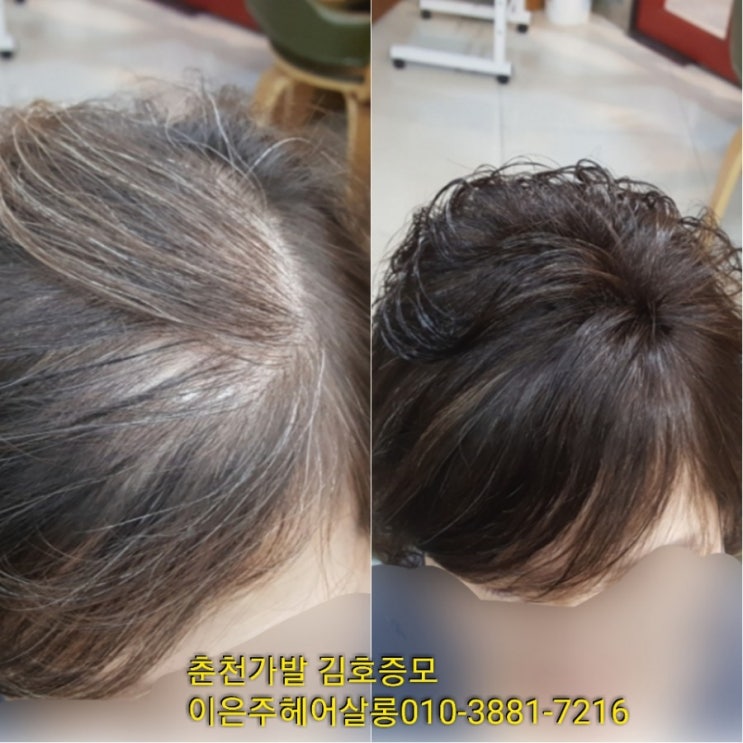  춘천가발 김호증모 탑부분가발 가볍고 자연스러워 바로 살께요~