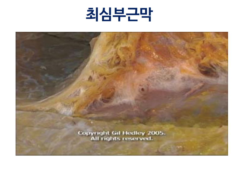 근막의 구성 : 네이버 블로그