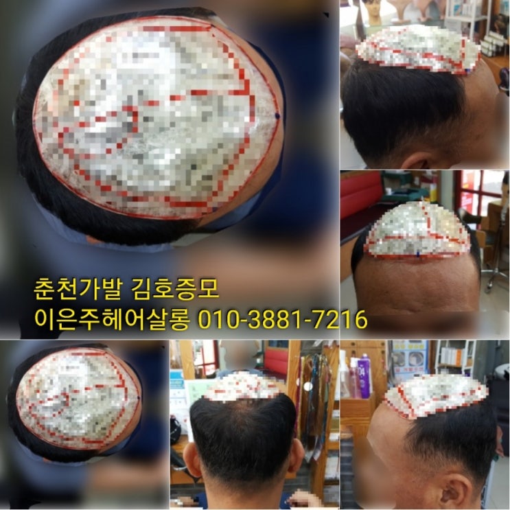  춘천가발 김호증모 남자맞춤가발 이은주헤어살롱에서 합니다~^^