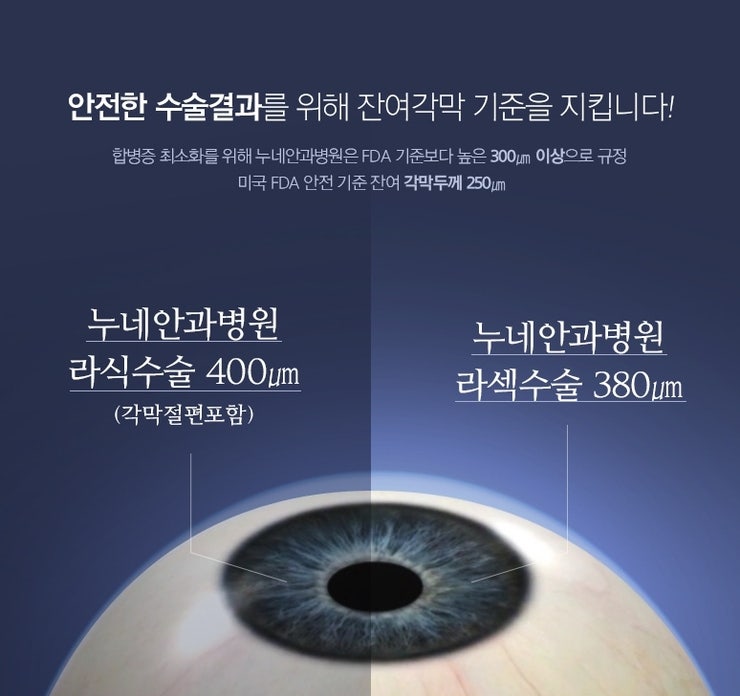 대구 라식 수술을 잘하는 곳 4