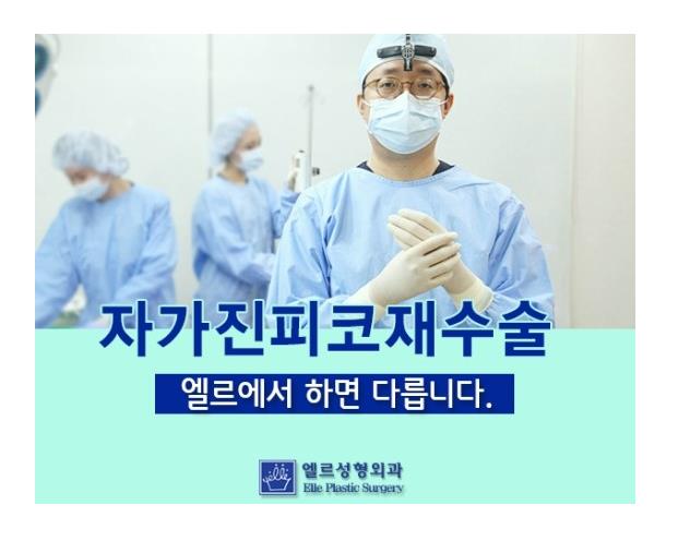  자가진피코재수술 되찾고 싶어요