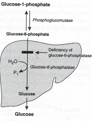 Glucose 6 Phosphatase Deficiency Doll Face