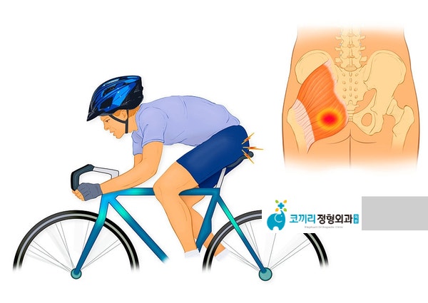허벅지 bursa 자전거