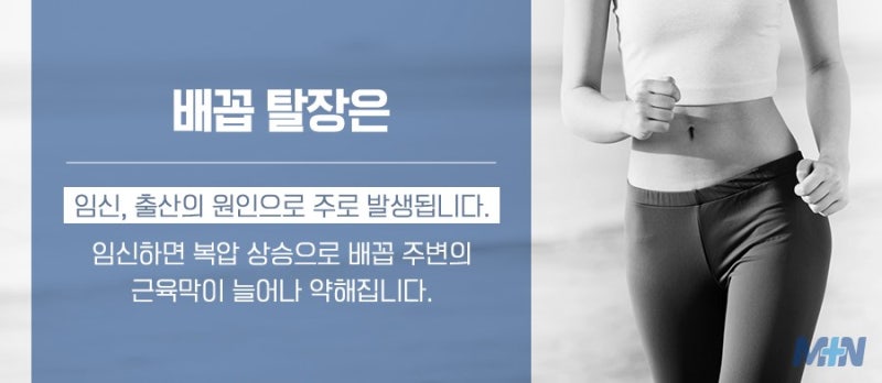 성인배꼽탈장 치료는 어떻게 할까?