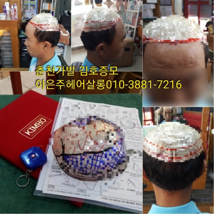  춘천가발 김호증모 반전두남자맞춤가발 본뜨기와 기존가발파마 후 피팅하기~
