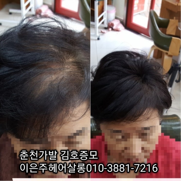  춘천가발 김호증모 부분가발 가볍고 시원한 탑피스 탑가발 기성및 맞춤피스 직접제작해 드리고 있는 이은주헤어살롱으로 오세요~^^