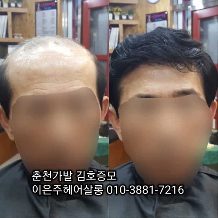  춘천가발 김호증모 반전두남자맞춤가발 이은주헤어살롱에서 피팅하는 날~^^