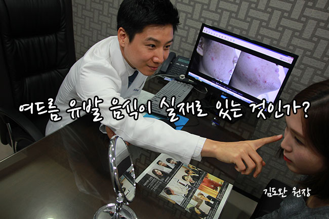  여드름 유발 음식이 실재로 있는 것인가?